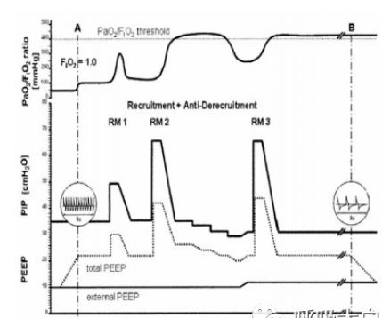 超實用臨床干貨 機械通氣使用之呼吸機模式選擇及參數設置 2