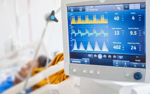 高值醫(yī)械國產(chǎn)替代路徑探析 微創(chuàng)模式與ST模式呼吸機(jī)的未來發(fā)展