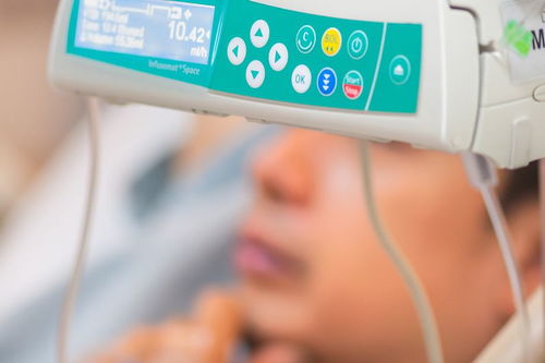 瑞思邁S9 Auto25與VPAP ST呼吸機對比 哪款更適合ST模式需求？